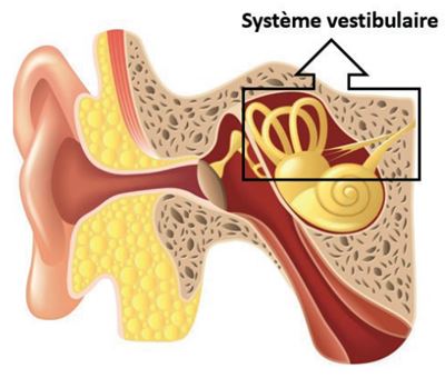 Les troubles du système vestibulaire